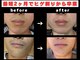 レイズ(Reyz)の写真