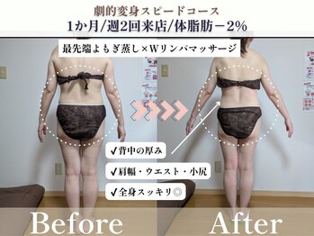 ヨサパーク アエル(YOSA PARK AELL)/1ヶ月で♪/よもぎ蒸し/痩身/整体