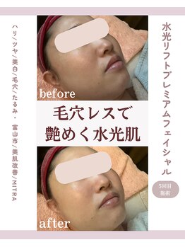 ミトラ(MITRA)/毛穴レスで艶めく水光肌☆