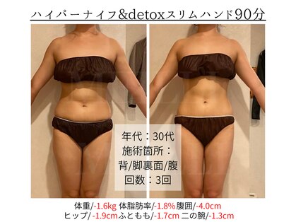 メイリー(MEILLI)の写真