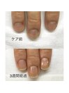 美爪育成ケア(１回お試し)