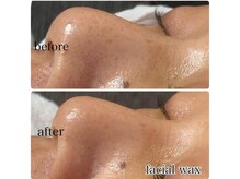 ここはな/普段落としきれない毛穴の汚れに