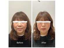 オン鍼灸整体院(ON鍼灸整体院)の雰囲気（一5歳は夢じゃない！ONの東洋の美容鍼灸）