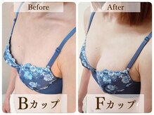 美人バスト リグラス(ReGrous)