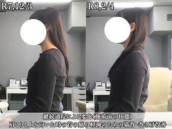 整体院 ワン(ONE)/施術2ヶ月の姿勢改善