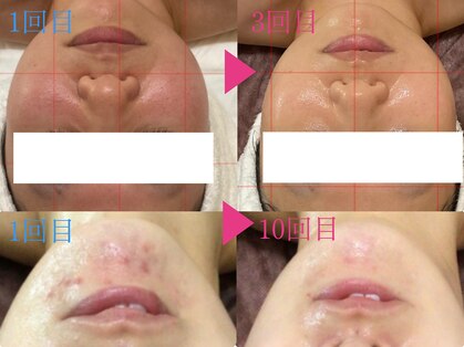 グレイスシャイン(GraceShine)の写真