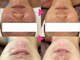 グレイスシャイン(GraceShine)の写真