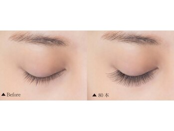 フランク(f)/装着イメージ【160本】