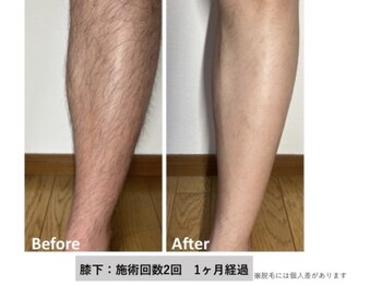 ダイアナ 出雲店(Daiana)/足キレイ