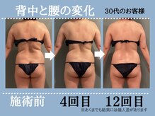 ボディエステティック アクアオーラ 高岡店/★背中と腰の変化★