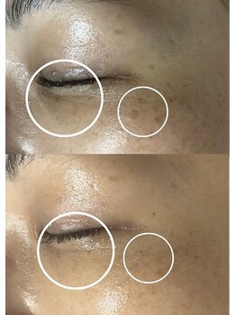 ベストベル(BestBelle)/シミ・小ジワケアも◎