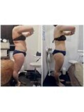 パーフェクトボディプレミアム 渋谷店(PERFECT BODY PREMIUM)/お客様　ビフォーアフター（17）