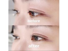 ドクターアリィ 岐南店(Dr.ALII)/どの角度からも可愛い目元に