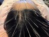 【施術後はスッキリ軽くなる♪】慢性的な頭痛に◎ルート鍼50分13000円