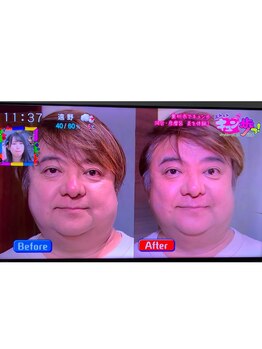 花音/彦摩呂さんも小顔になりました