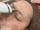 エヌコロン バイマイラッシュ(N:bymylash)の写真/ヒト幹細胞フェイシャルで乾燥肌、シミシワ改善も叶う♪毛穴洗浄を追加でさらに透明感のあるツルスベ肌に◎