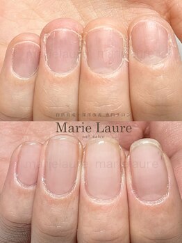 マリーロール 淀屋橋本店(Marie Laure)/自爪育成/深爪矯正/ネイルケア