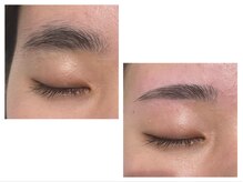 リノア(Linoa)/Wax脱毛（間引き、カット込み）