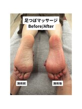 べっぷ餅ヶ浜整体院/足つぼマッサージbefore/after