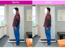 八女整体院/～姿勢改善～腰の痛み