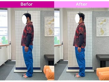 八女整体院/~姿勢改善~腰の痛み