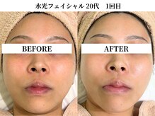 サンビ(SANBI)/顔のくすみにはしっかり保湿を