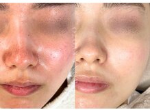 ウォナ(WONA)/【お客様症例】