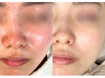 ウォナ(WONA)/【お客様症例】