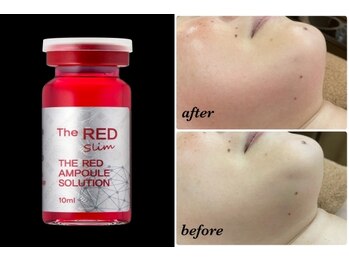 ハクミー(haku me)/脂肪分解&美肌/最新REDショット