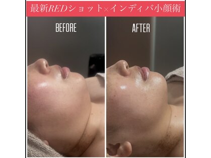 インディバサロン カルム(Calm.)の写真
