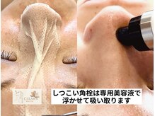 クリアホワイト(Clear White)/気になる鼻周りもスッキリ☆