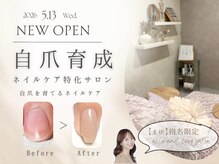 エムアール(MR)