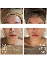 ビューティースタジオ ハンミ 福岡大名店(Beauty studio 韓美)/韓国式小顔コルギ