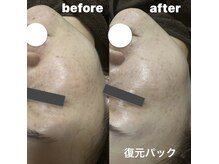 サロン リノ(SALON Lino)/ビフォーアフター