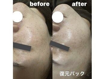 サロン リノ(SALON Lino)/ビフォーアフター