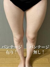 ヴィオラ(Viola)/遠赤外線バンテージ