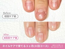 フェリエ(feerie)/Before/After【feerie立川】