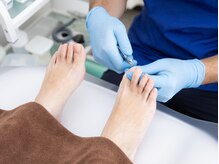 巻き爪補正店 松戸店/爪切り☆