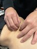 オーダーメイド鍼灸施術　60分　￥3980