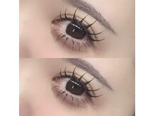 リメリー(Limery)の雰囲気(上下施術で中顔面効果◎)