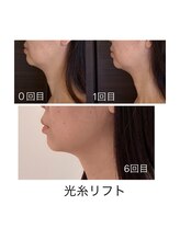 アトリエドゥアージュ(Atelier de age)/光糸[コウシ]リフト40