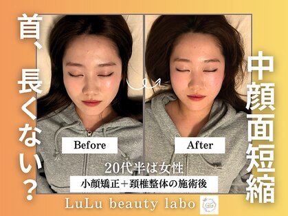 ルルラボ(LuLu beauty labo)の写真
