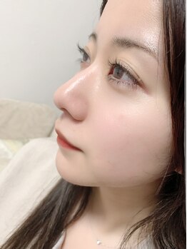 スパークル。/まつ毛パーマ