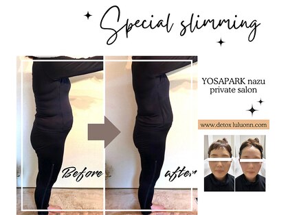 ヨサパーク ナズ(YOSA PARK nazu)の写真