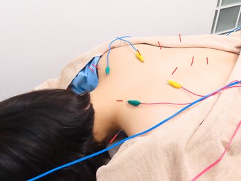 なかのぶスキップロード整骨院 鍼灸院/電気鍼