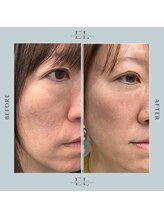 サロン ド ラヴィエール(salon de Laviere)/