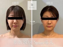 ヤエシーファイブクリニック(YAE C5 CLINIC)の雰囲気（札幌エステ/大通/桑園/フェイシャル/小顔/痩身/耳ツボジュエリー）