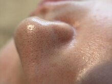 リセットプラス(Reset+)/