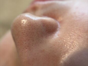 リセットプラス(Reset+)/