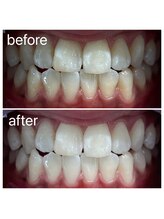 ホワイトマジック(White Magic)/before→after